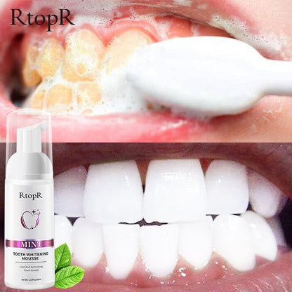 X Tooth Whitening Mousse™