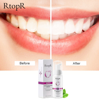 X Tooth Whitening Mousse™